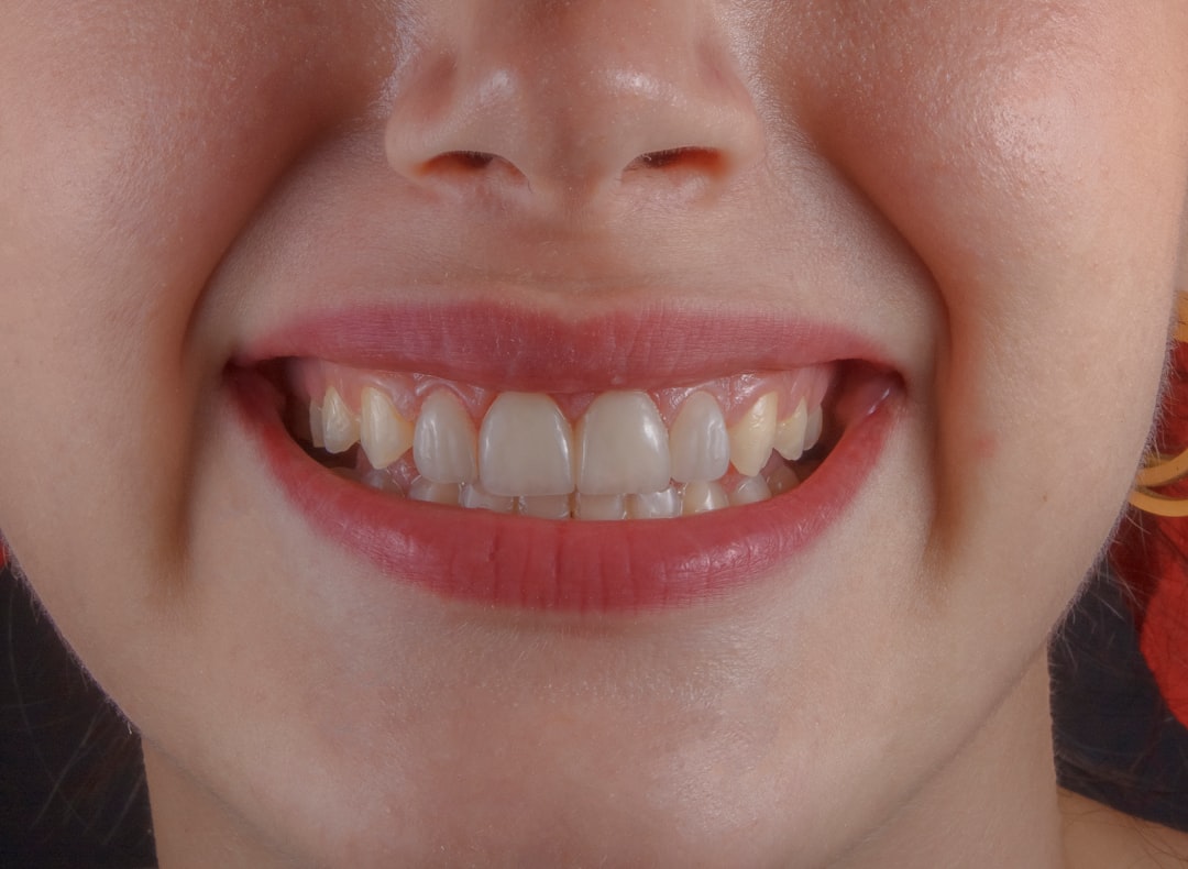 dientes bebe orden - El cepillado comienza cuando aparece el primer diente.