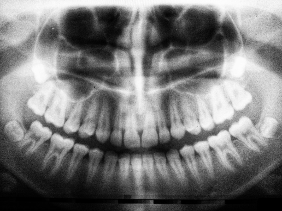 radiografia dientes bebe - La revisión odontopediátrica permite valorar la salud de los dientes de leche.